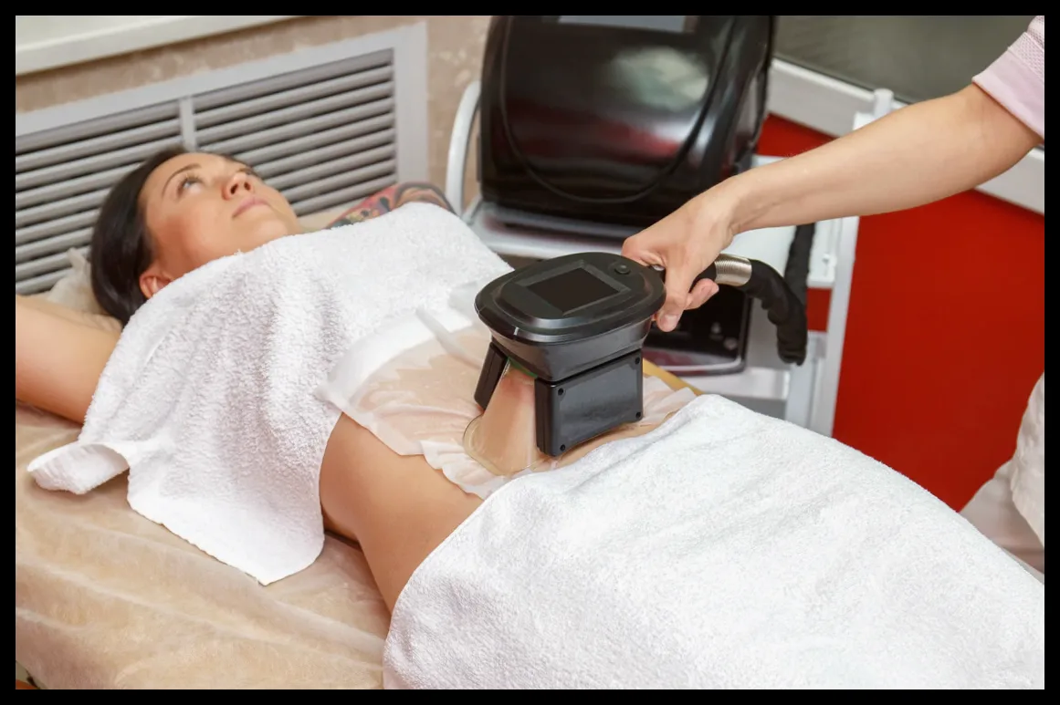 CoolSculpting چیست و چگونه چربیهای مقاوم بدن را منجمد میکند؟